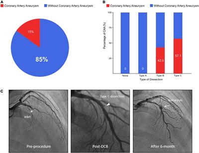 Coronary artery aneurysm formation after paclitaxel-coated balloon-only intervention for de novo coronary chronic total occlusion